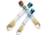 BD Vacutainer<sup>®</sup> CPT™ Mononuclear Cell Preparation Tube (IVD)